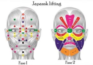 japansk lifting klinik agervig